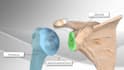 create medical device 3d surgery process explainer animation surgical simulation