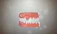 do 3d dental implant animation, patient education, explainer video