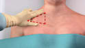 create 3d medical surgery animation and surgical procedure