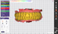 provide professional exocad dental cad design services