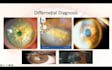 create professional ophthalmology medicine powerpoint presentations