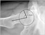 explain and simplify your mri ct scan and xray reports