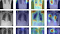 build ai deep learning models for disease detection from xray and mri scans