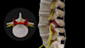 create 3d orthopedic spine and musculoskeletal animation anatomy video