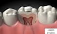 create cinematic 3d medical animation, dental explainer video