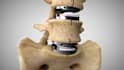 create 3d medical animation surgical procedure orthopedic medical device video
