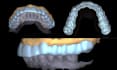 design occlusal splints, night guards and retainers