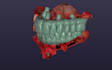 design high quality aox and immediate loading prosthesis