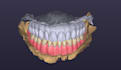 design functional and esthetic removable denture