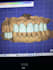 create professional exocad dental cad designs