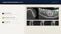 design your digital implant case presentation