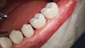 create 3d dental animation, dental procedure, dental implant and oral surgery