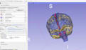 create research grade brain ct mri dicom 3d segmentation and models