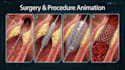 create professional ai medical explainer and anatomy animations