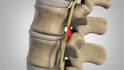 create realistic 3d spine animation and surgical visualization