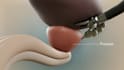 create 3d robotic surgery animation robot assisted prostatectomy viodeo