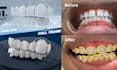 design any high end custom grillz in 3d cad
