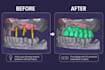 provide professional dental cad design using exocad
