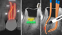 create engaging endodontic dental motion graphics videos
