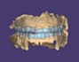 dental cad design service