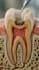 create cinematic 3d dental and medical animations