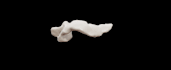 convert dicom to stl for medical 3d printing