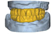 do professional all on x and full arch dental cases on exocad