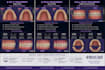 do orthodontic treatment planning and clear aligner setups
