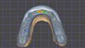 design custom cad night guards and occlusal splints