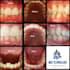 professional clear aligner treatment planning