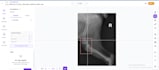 annotate medical images with precise masks, polygons and bounding boxes