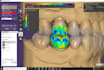 design dental crowns from stl scans using cad software