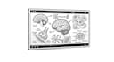 make white board animation or medical explainer videos