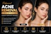 remove pimples, acne, scars and skin blemishes