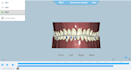 do clear aligner treatment planning setup and stepping