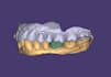 design crowns, bridges, implants, dentures using exocad
