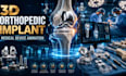 create 3d orthopedic implant medical device animation