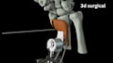 create 3d medical animation, surgical animation, surgery animation video
