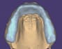 teach you how to design by exocad