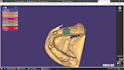 create professional dental cad designs using exocad