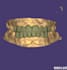 design custom crowns, bridges using exocad