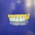 design crowns, bridges and implants professionally in exocad