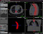 segment and analyze ct and mri medical images in imagej
