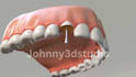 create 3d medical animation, dental implant and teeth surgery animation