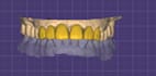 design natural looking dental veneers