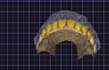 design custom exocad anterior smile makeovers and full arch restorations