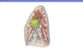 segment medical data and create accurate medical 3d models