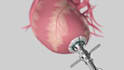 create 3d medical device and surgical product animation