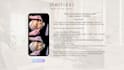 video editing for beauty creators and aesthetic clinics