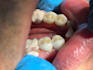 teach you prosthodontics step by step